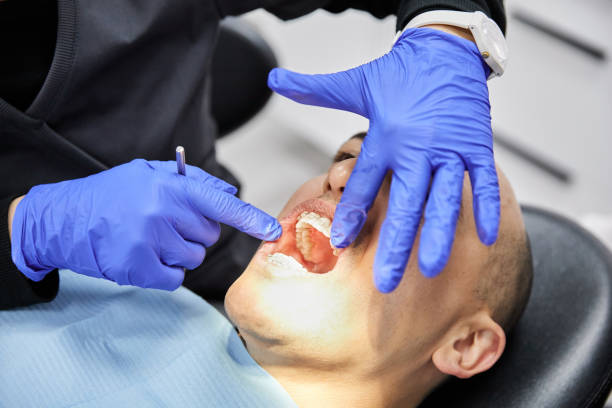 Best Emergency Broken Tooth Repair in Fort Payne, AL